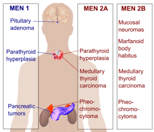 Read more about the article Multiple Endocrine Neoplasia (MEN)