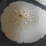 Candidiasis (Thrush)