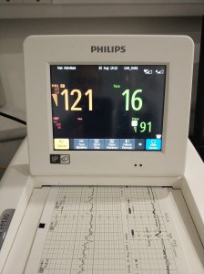 Read more about the article CTG – Cardiotocography