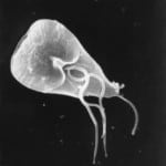Giardiasis