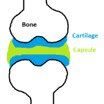 Osteoarthritis – OA