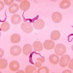 African Sleeping Sickness