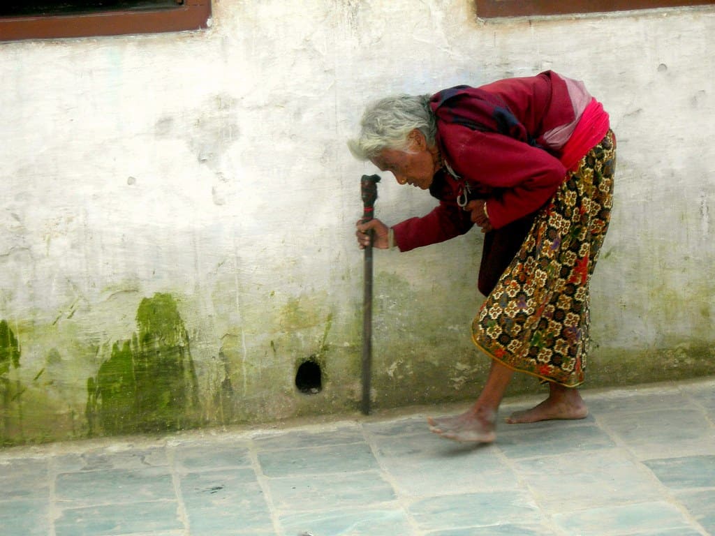 Lady with arthritis