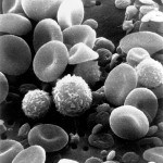 Comparison and Summary of White Cell Disease