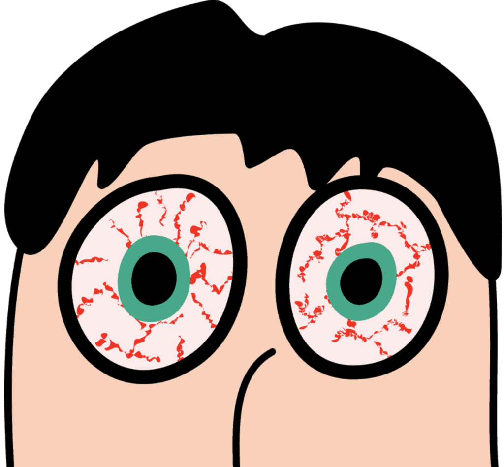 Dry Eyes