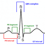 Understanding ECGs