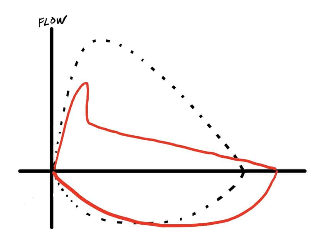 Spirometry almostadoctor